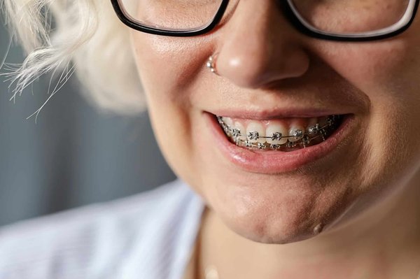Quels sont les avantages des traitements d'orthodontie offerts par les dentistes locaux ?